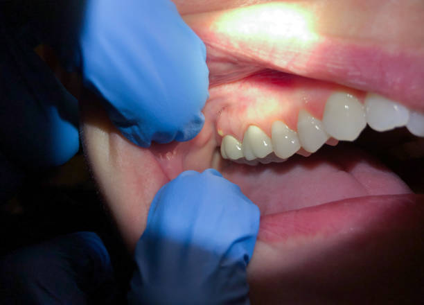 Best Emergency Broken Tooth Repair in Eldorado, TX