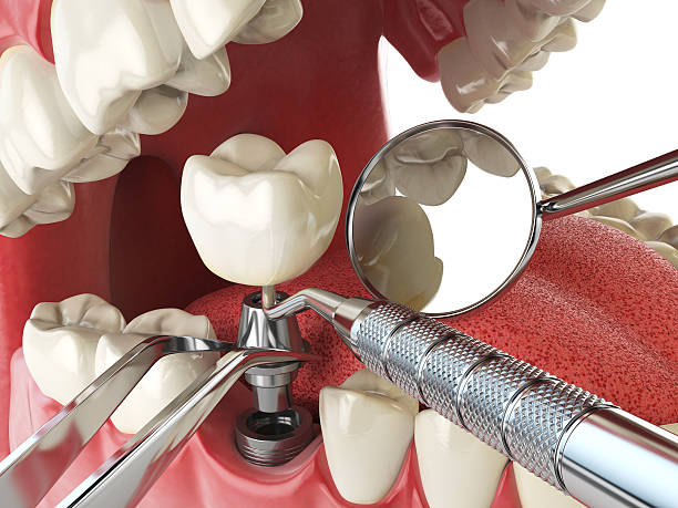 Best Emergency Orthodontic Repairs in Eldorado, TX